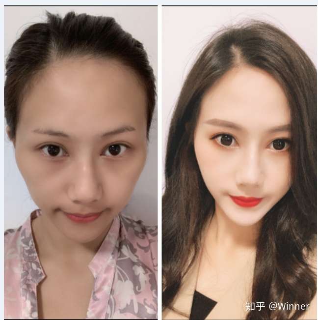 请问云南有哪些好的鼻子整形的医院.
