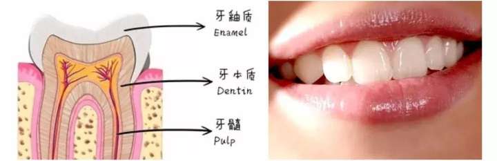 大家先要了解一个常识——大部分人类的牙齿天生就是淡黄色的,这是