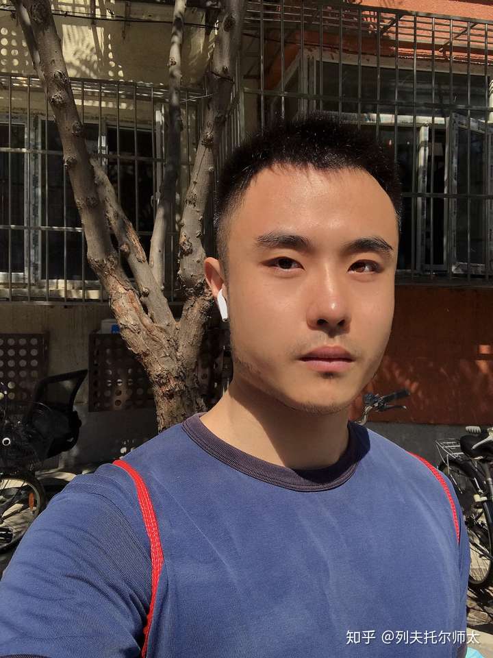 现实生活中真的有异瞳人么?