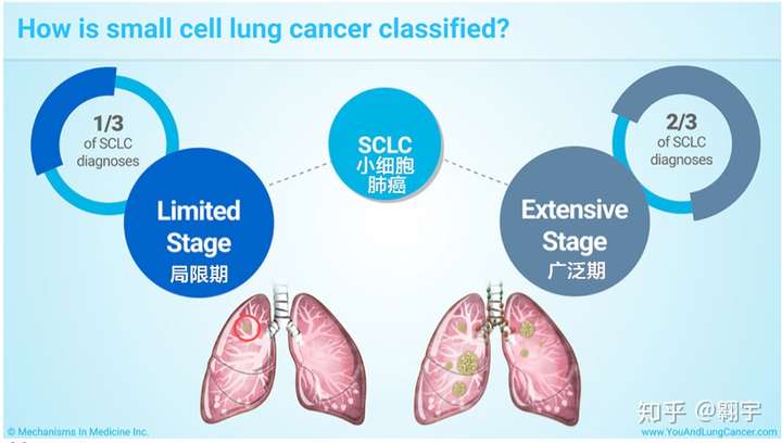 小细胞肺癌转移到脑部一般情况下可以活多久