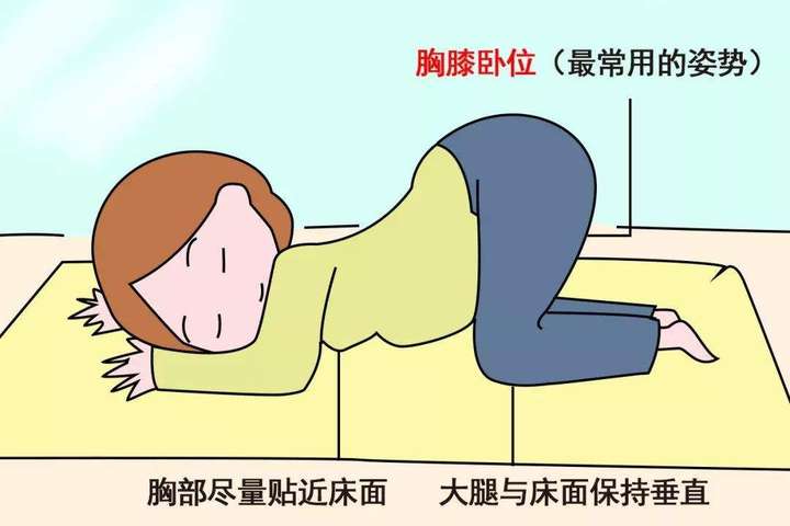 为什么胎儿会出现不同的胎位? 大概在什么时候会自动转到头朝下?