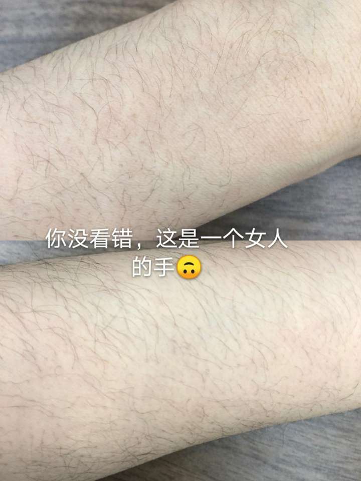 女生体毛旺盛是什么样的体验