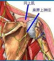 冈上肌肌腱炎可以进行背部训练吗