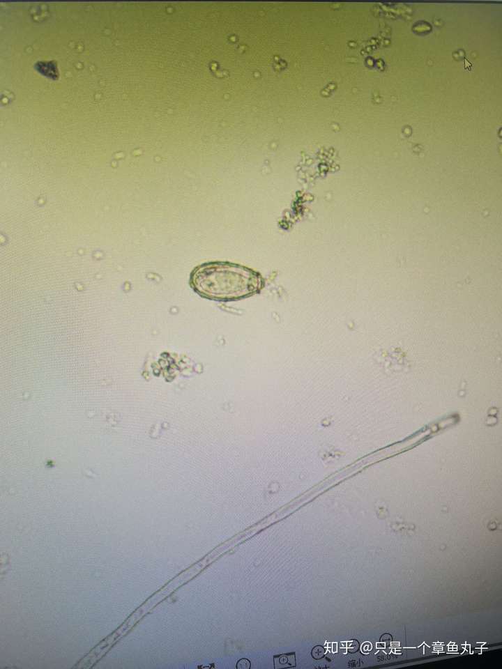 吸虫(姜片虫 血吸虫 绦虫 曼氏迭宫绦虫 带绦虫 微小膜壳绦虫 线虫