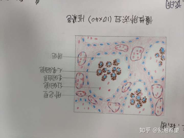 为什么咱们不弄个病理红蓝手绘图的问题呢?