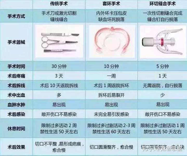 记录下钛钉法吻合器割包皮的心路历程