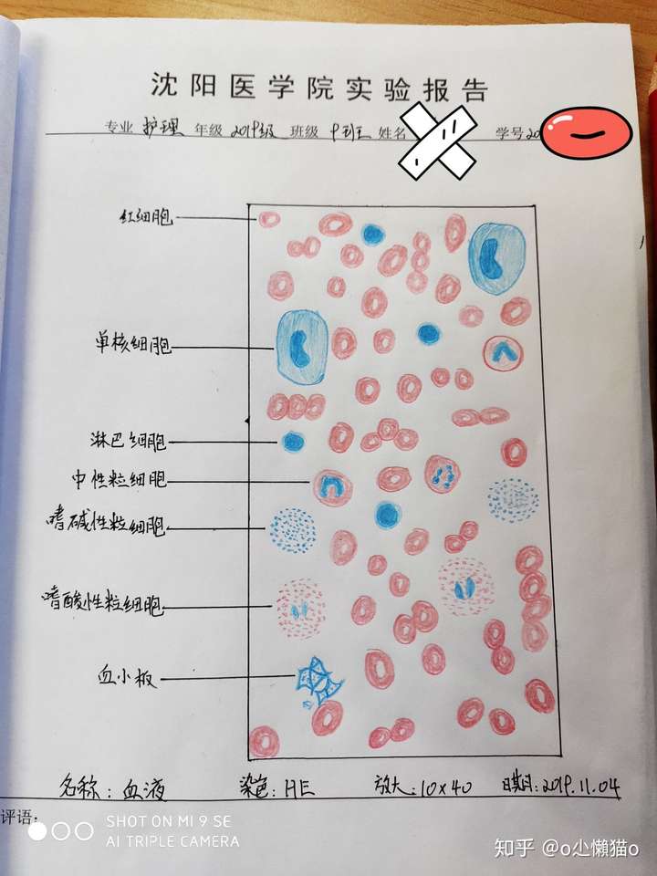 有没有红蓝铅笔血涂片的手绘图?