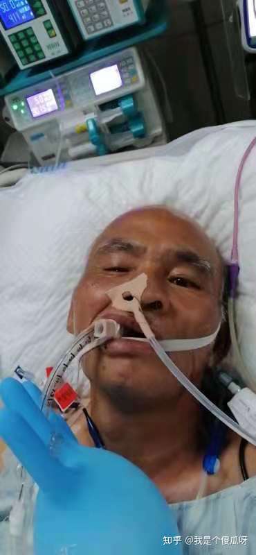父亲脑梗塞昏迷医生模凌两可救活大概率是植物人全力救的话影响生活