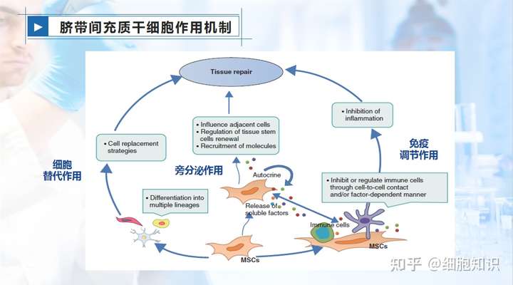 生产时,脐带间充质干细胞该保存吗?