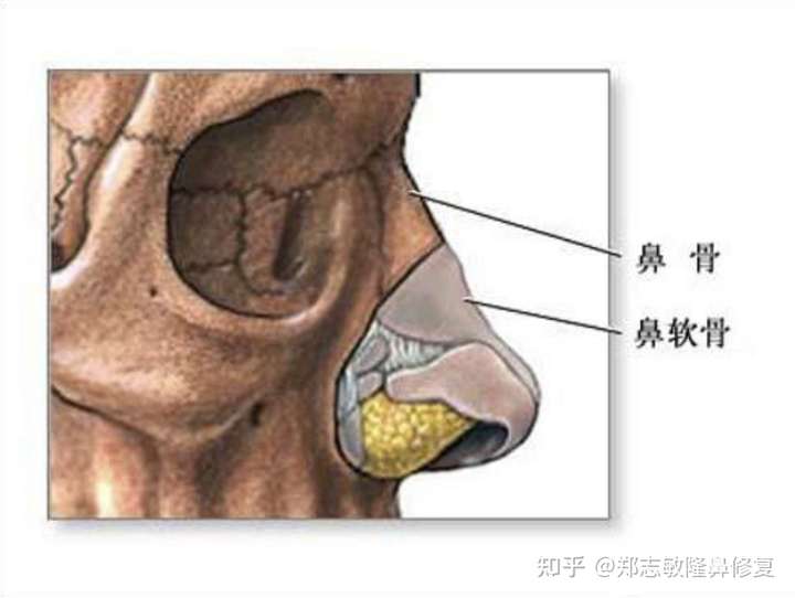 鼻骨作为骨性结构绝对不是捏一捏就能改变,它是受父母基因决定的.