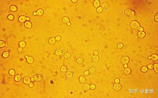 大便里一般是念珠菌,它是真菌中最常见的条件致病菌,常寄生于人的皮肤