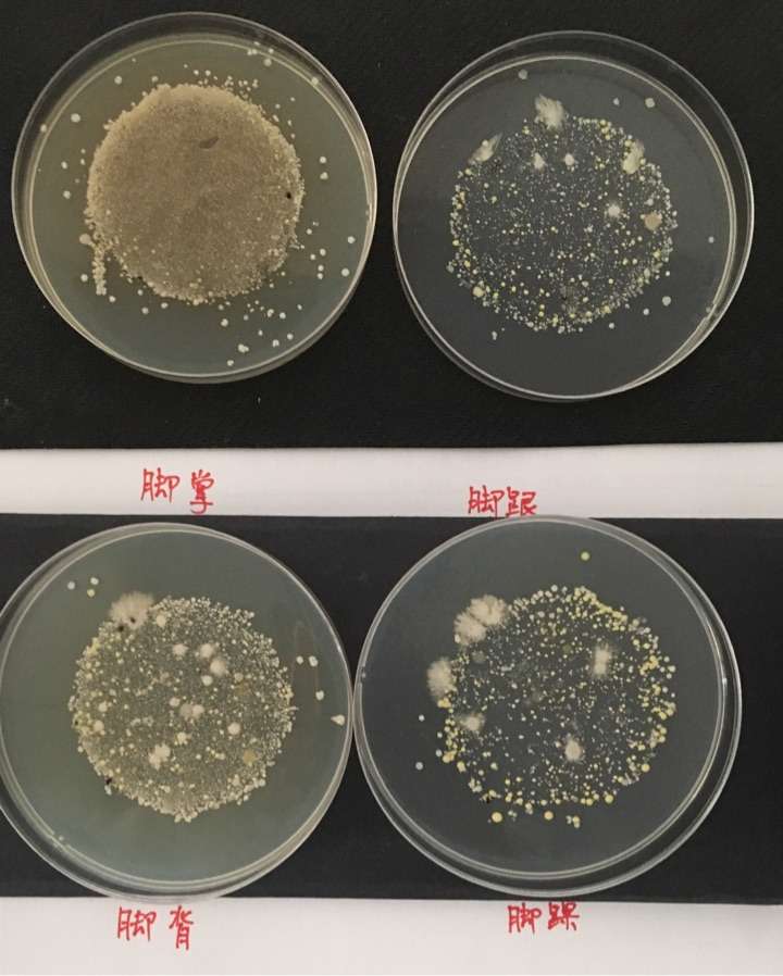 造成脚气的真菌,如果放在培养皿上培养,会变成蘑菇或肉眼可见的东西吗