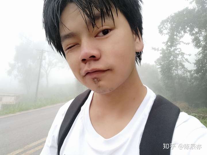 单眼失明是种怎样的体验?
