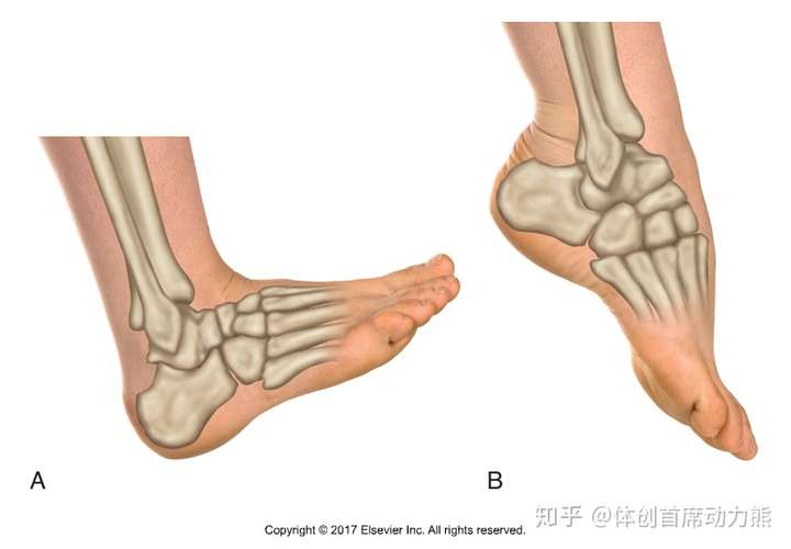 脚踝背屈关节受限,可能跟小腿肌群的张力,胫腓关节的宽度,距骨的活动