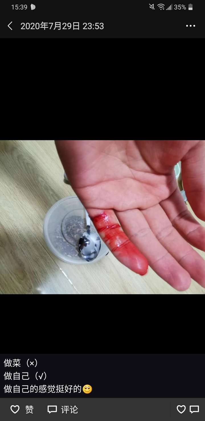 手上有伤口该如何洗手