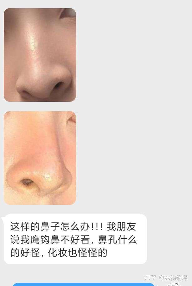 反正看起来特别难看,而且还老是被人嘲笑是"牛鼻子".