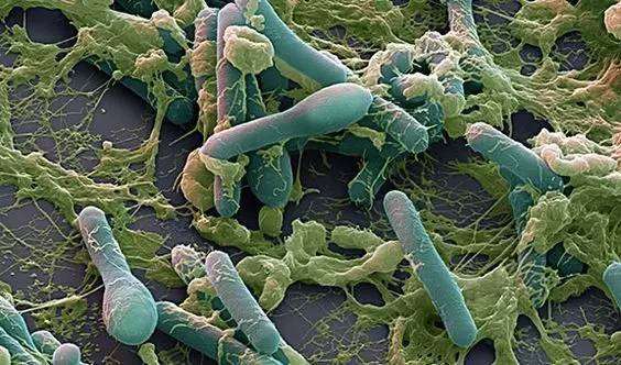 电子显微镜下的肉毒梭菌