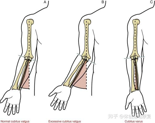 也可能跟您的提携角有关 当肘关节伸直,前臂处于旋后位时,臂与前臂并