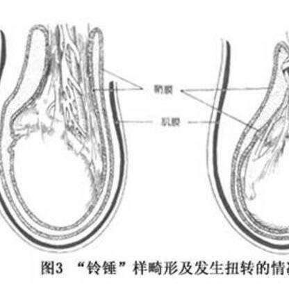 睾丸(testis)位于阴囊内,左右各一,一般左侧略低于右侧1mm.