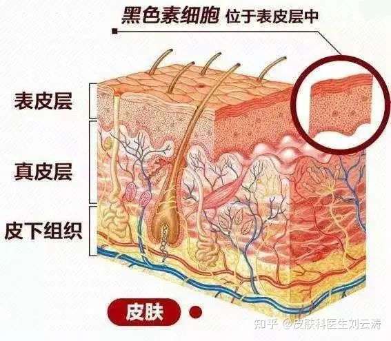 黑色素瘤有哪些表现?致病原因是什么?该如何预防和治疗呢?