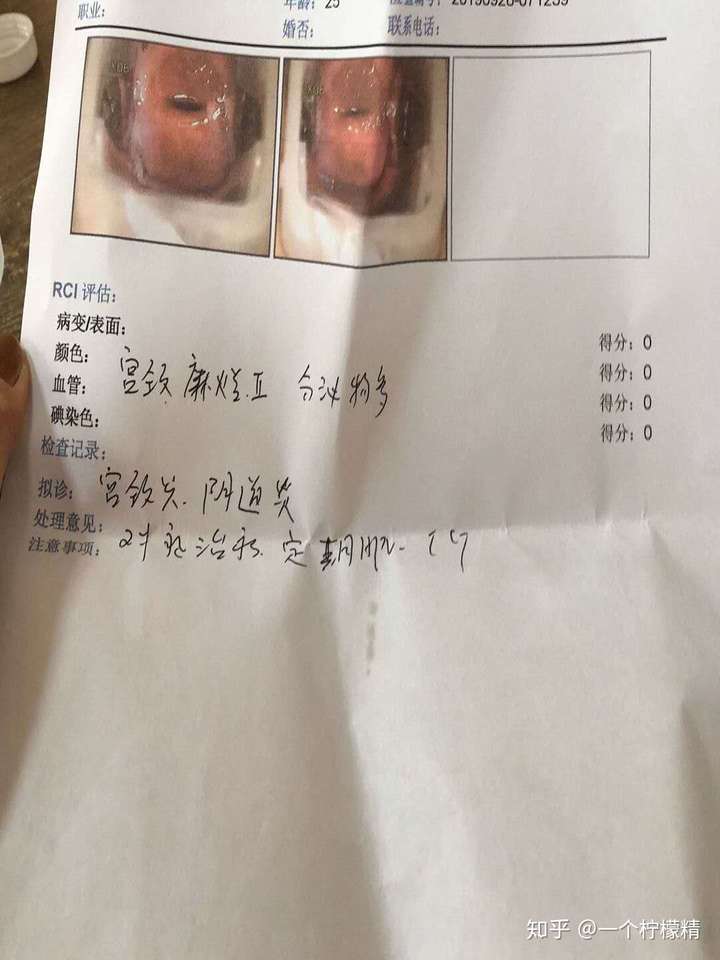 宫颈阳性严重吗 zhuanlan.zhihu.com