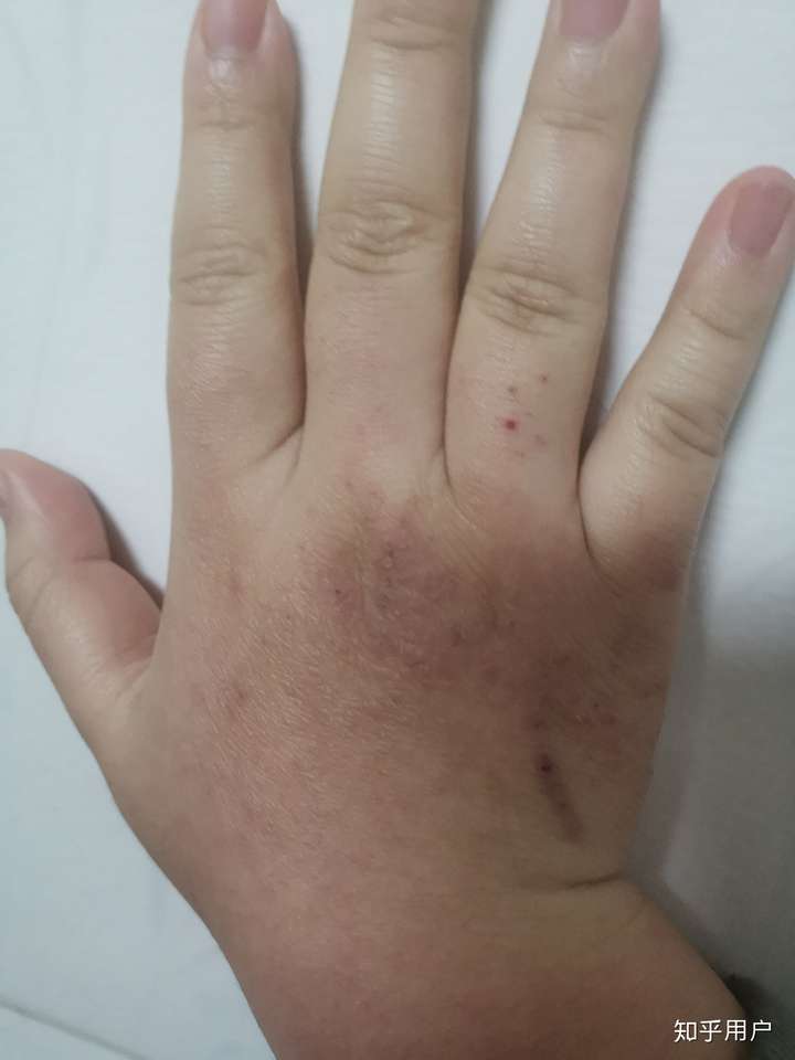 胖胖的男生拥有一双小胖手是什么体验?