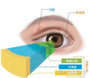 干眼症你是怎么治疗的