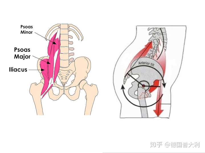 图一彩色的部分则是髂肌和腰大肌;图二红色的部分为屈髋肌