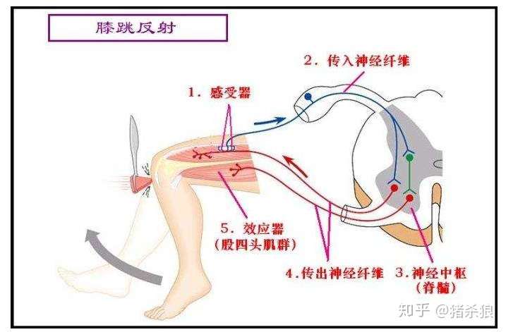 为什么选d,神经中枢不是坏了吗,为什么还能有膝跳反射