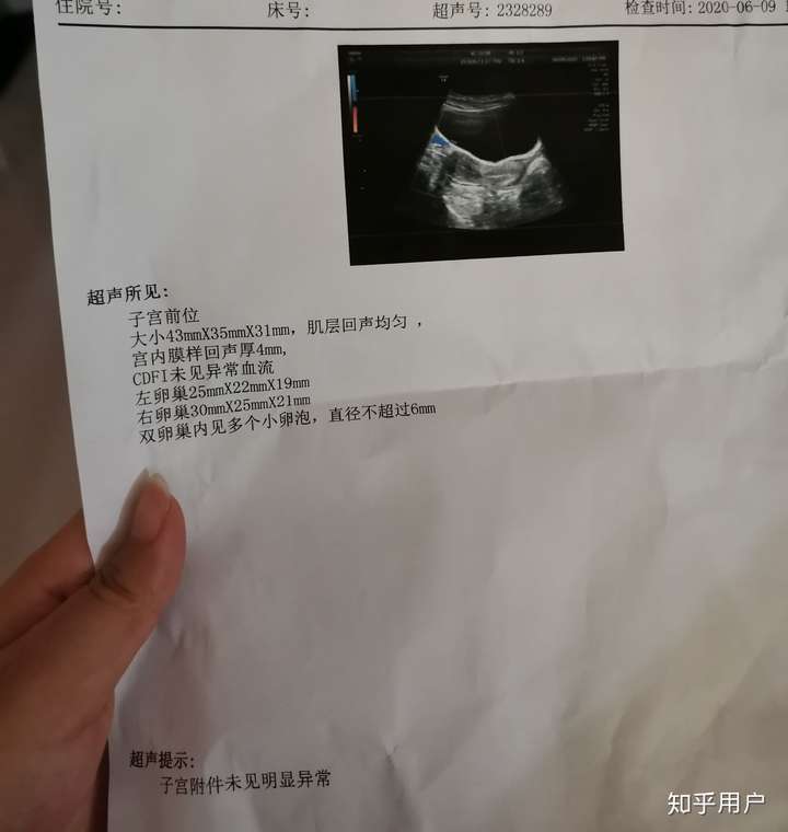 女生肚子上长毛怎么办?