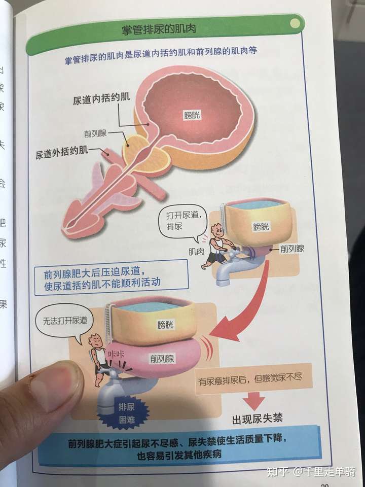 谁有过前列腺炎尿频啊?有治好的给说下,谢谢了