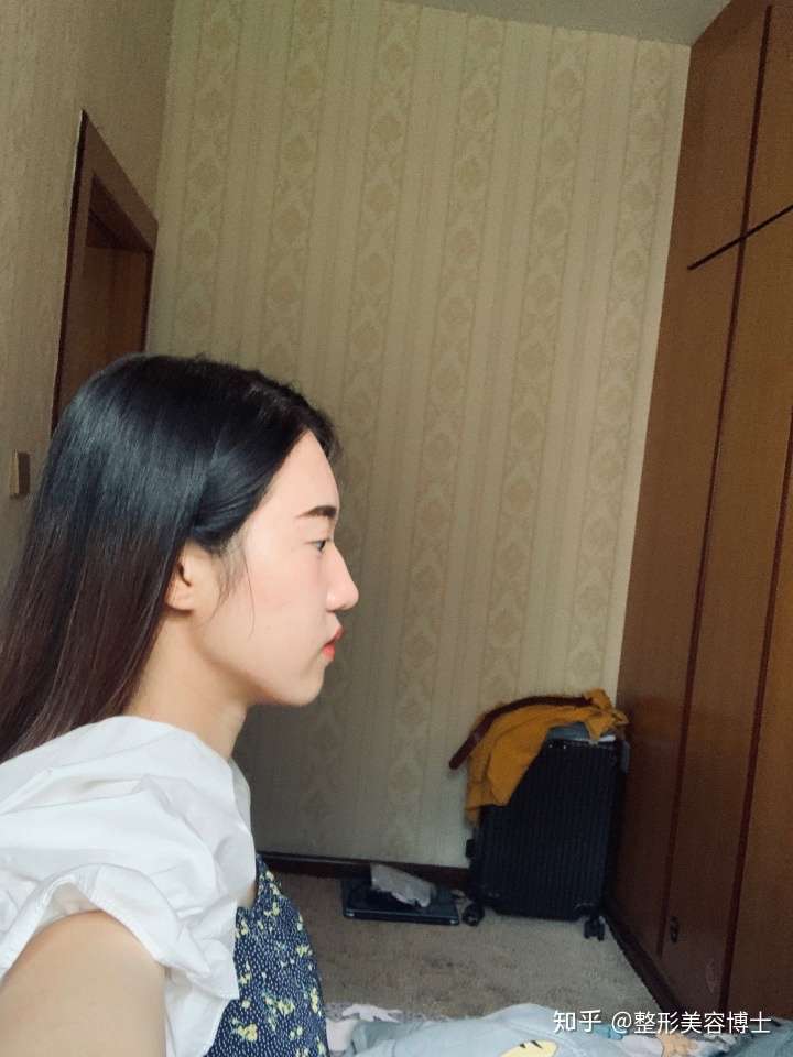 好看的美人线即下颌线清晰,流畅,角度120度左右 2.