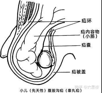 宝宝的蛋蛋上出现这2种情况一定要尽早看医生