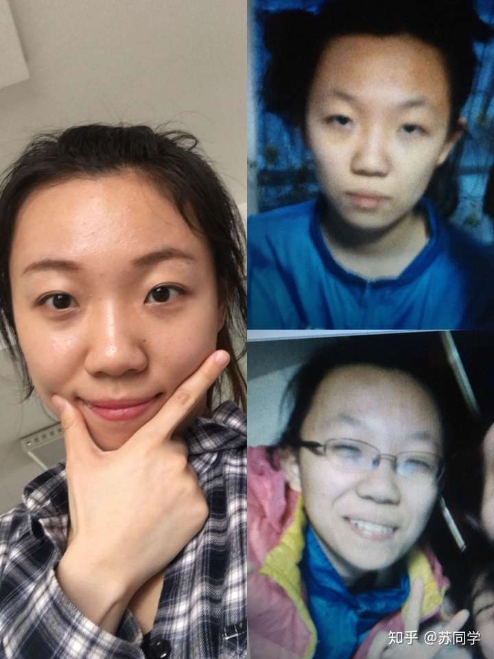 那个时候经常会被说丑,不好看,人好但就是长得……(一个男同学对我
