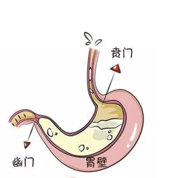 婴儿吐奶是什么原因怎么处理