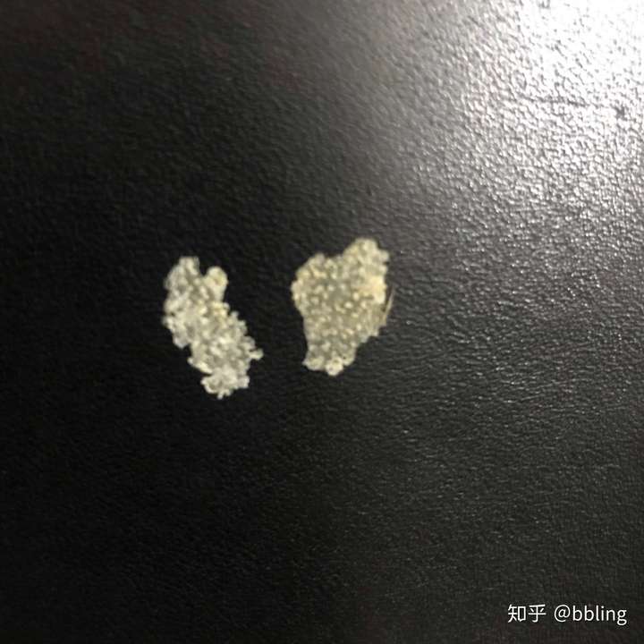 然后发现头皮痒,挠一下发现有异物扣一下就扣出来这么一大块,虽然不