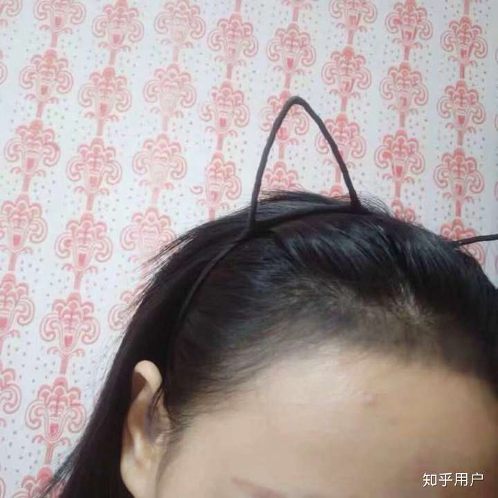 emm女孩纸老掉头发怎么办?(害怕自己秃了)?