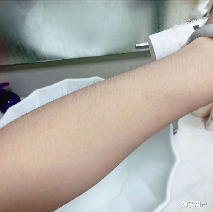 夏天到了,又该穿短袖裙子了,胳膊上的汗毛又多又长,然后我就用 脱毛