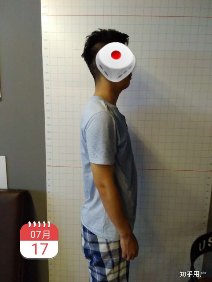 以后: 这是7月26日 目前为止,改善不少,最起码脖子前倾得到了有效改善