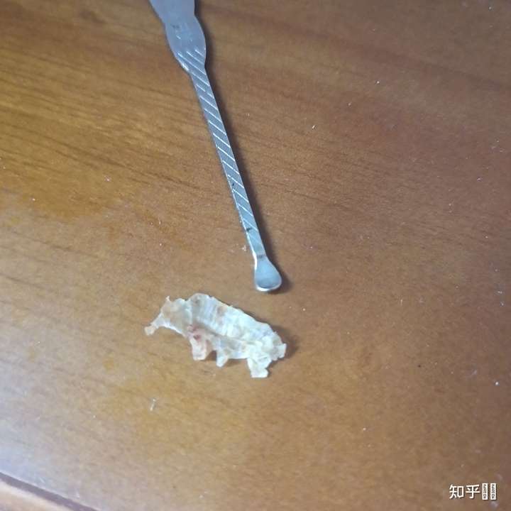 你们掏出来的耳屎有多大