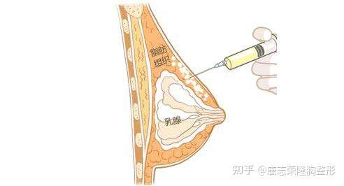 之前查了