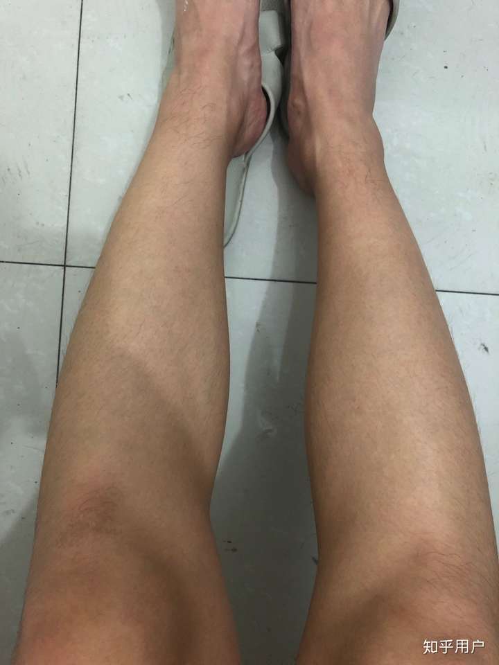 为什么女装大佬艾比没有腿毛?