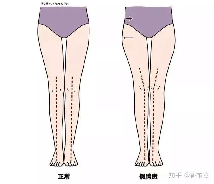 超级严重的梨形身材 大腿前侧突出怎么办?