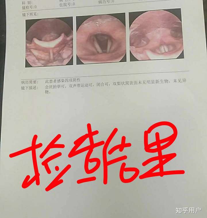 做过喉镜的人能来说下吗?你们做的时候难受吗?什么感觉?