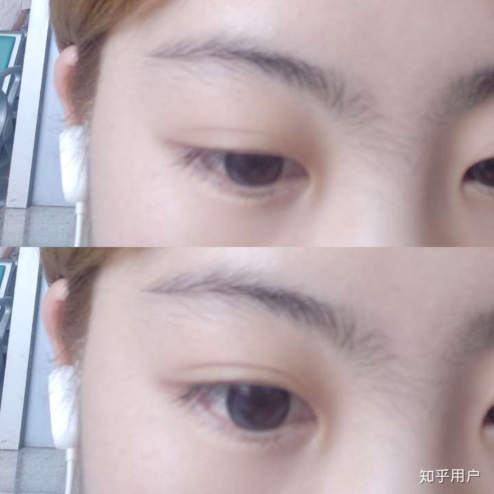 你见过的眼睛大的人,眼睛有多大?