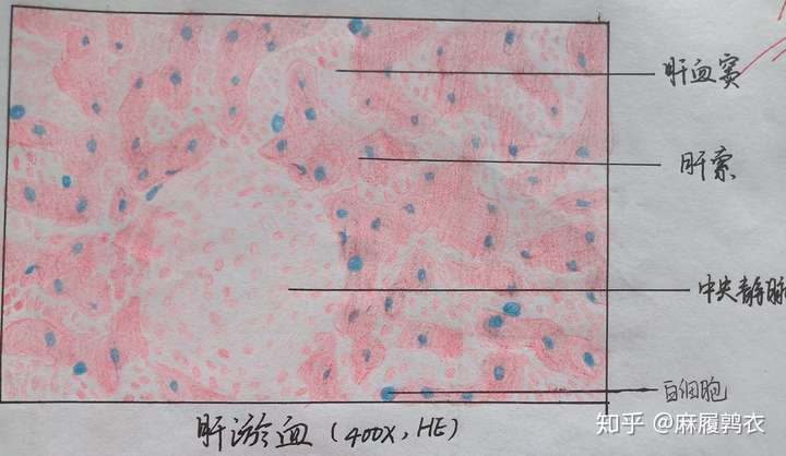 为什么咱们不弄个病理红蓝手绘图的问题呢