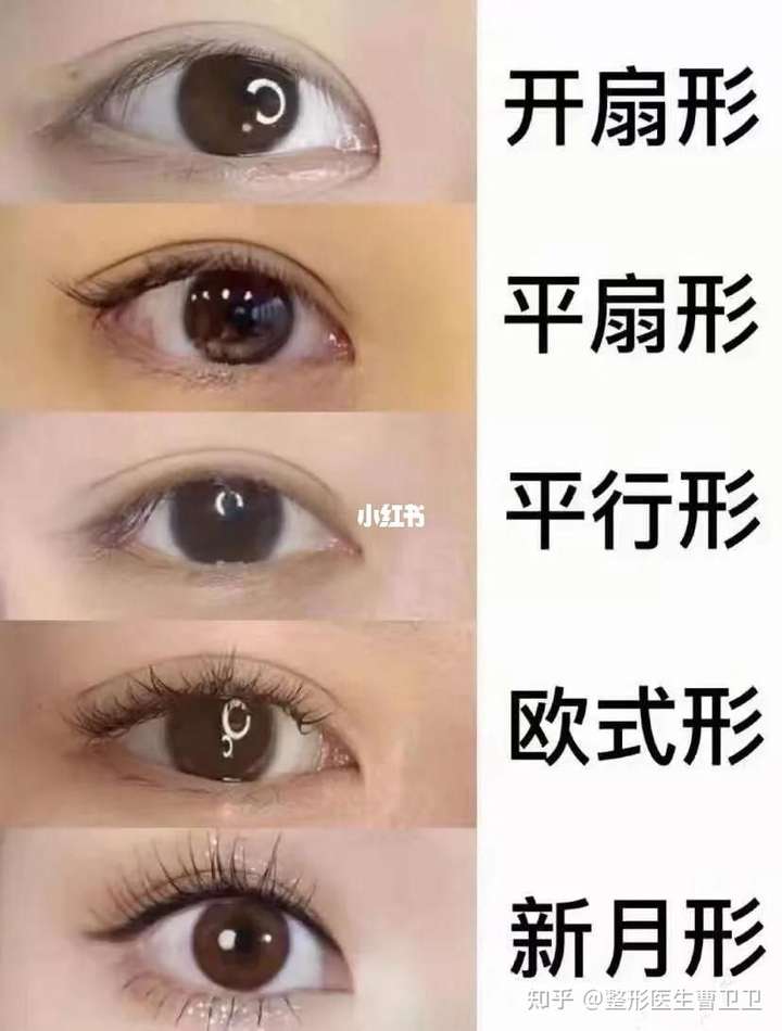 哪种双眼皮最好看双眼皮有几种?