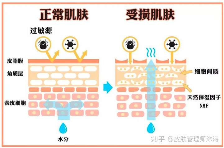 脸上的角质层全部去掉会怎么样?