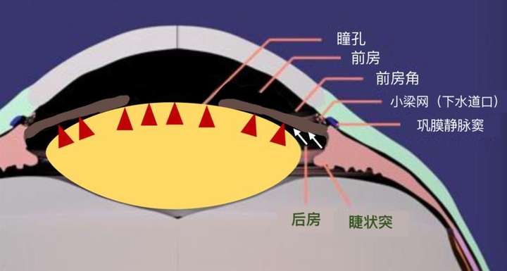 高度近视的亲们眼压一般多少呀?