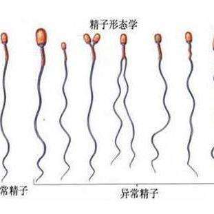 分析主要可以了解精液量,精子密度及其精液中精子的总数量,精子凝集